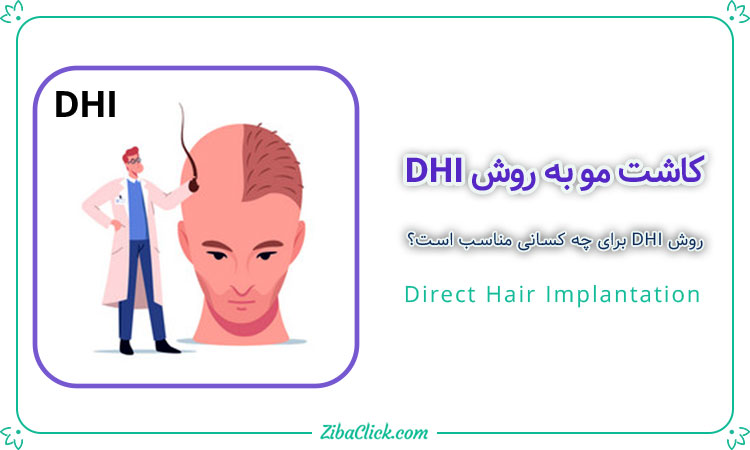 کاشت مو به روش DHI