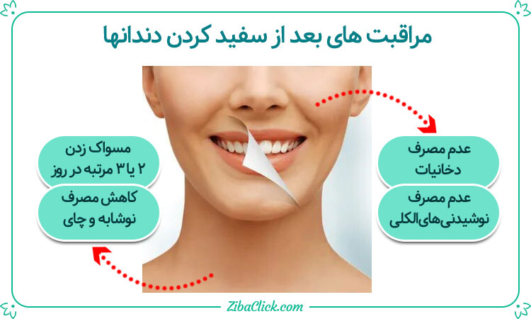 مراقبت بعد از سفید کردن دندان