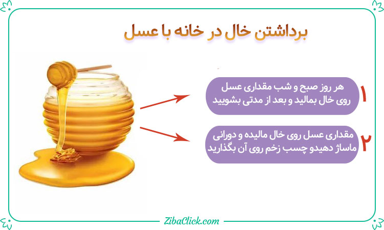 درمان خال با عسل