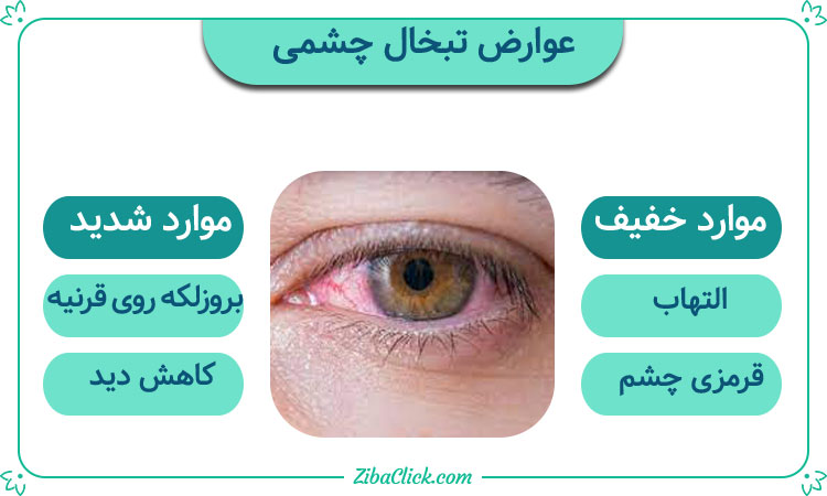 عوارض تبخال چشم
