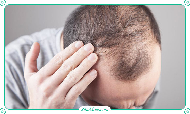 استرس ممکن است باعث نازک شدن تار موی افراد و تغییر در چرخه طبیعی مو شود.