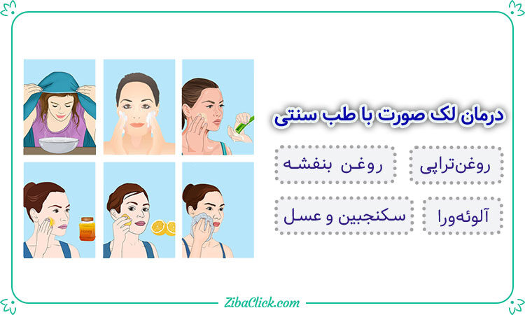 درمان لک صورت با طب سنتی(درمان لک صورت با قران)