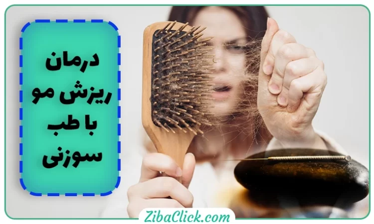 درمان ریزش مو با طب سوزنی