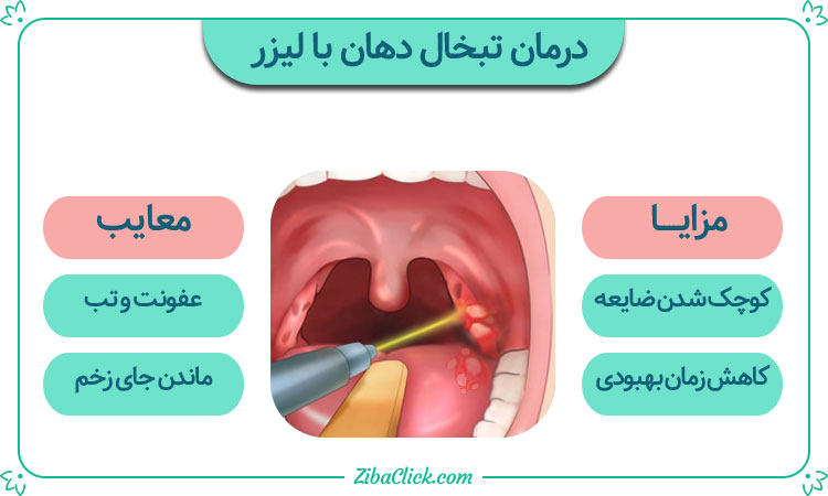 درمان تبخال دهان با لیزر