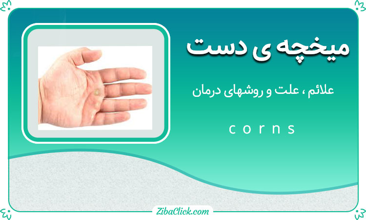 درمان میخچه دست